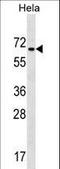 Zinc Finger Protein 35 antibody, LS-C160858, Lifespan Biosciences, Western Blot image 