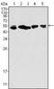 Keratin 8 antibody, GTX83140, GeneTex, Western Blot image 