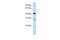 GRAM Domain Containing 2A antibody, GTX46673, GeneTex, Western Blot image 