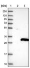 Guanylyl Cyclase Domain Containing 1 antibody, NBP1-93512, Novus Biologicals, Western Blot image 