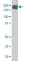 CDC42 Binding Protein Kinase Beta antibody, H00009578-M02, Novus Biologicals, Western Blot image 