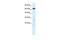 Mediator Complex Subunit 17 antibody, PA5-40839, Invitrogen Antibodies, Western Blot image 