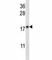 O-6-Methylguanine-DNA Methyltransferase antibody, F43302-0.4ML, NSJ Bioreagents, Western Blot image 