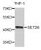 SET Domain Containing 6, Protein Lysine Methyltransferase antibody, orb247869, Biorbyt, Western Blot image 