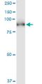 Phosphodiesterase 5A antibody, H00008654-M02, Novus Biologicals, Western Blot image 