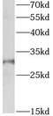 Aph-1 Homolog A, Gamma-Secretase Subunit antibody, FNab00481, FineTest, Western Blot image 