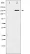 Rho Associated Coiled-Coil Containing Protein Kinase 1 antibody, abx011483, Abbexa, Western Blot image 