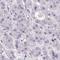 TNF Receptor Superfamily Member 10a antibody, HPA054475, Atlas Antibodies, Immunohistochemistry frozen image 