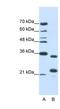 AlkB Homolog 8, TRNA Methyltransferase antibody, NBP1-80474, Novus Biologicals, Western Blot image 
