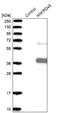 Ankyrin Repeat Domain 45 antibody, NBP1-85421, Novus Biologicals, Western Blot image 