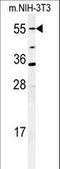 Cytochrome P450 Family 26 Subfamily A Member 1 antibody, LS-C167213, Lifespan Biosciences, Western Blot image 