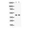 Absent In Melanoma 2 antibody, LS-C407895, Lifespan Biosciences, Western Blot image 