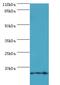 Transmembrane Protein 141 antibody, LS-C370436, Lifespan Biosciences, Western Blot image 