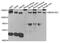 SWI/SNF-Related, Matrix-Associated Actin-Dependent Regulator Of Chromatin, Subfamily A, Containing DEAD/H Box 1 antibody, PA5-76839, Invitrogen Antibodies, Western Blot image 