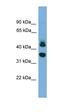 Sorting Nexin 32 antibody, orb326003, Biorbyt, Western Blot image 