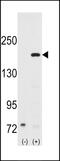 Nuclear Receptor Coactivator 1 antibody, 63-001, ProSci, Western Blot image 