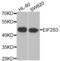 Eukaryotic Translation Initiation Factor 2 Subunit Gamma antibody, PA5-76845, Invitrogen Antibodies, Western Blot image 