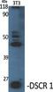 Regulator Of Calcineurin 1 antibody, PA5-50952, Invitrogen Antibodies, Western Blot image 