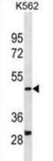 Dihydroorotate Dehydrogenase (Quinone) antibody, abx031005, Abbexa, Western Blot image 