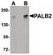 Partner And Localizer Of BRCA2 antibody, PA5-20796, Invitrogen Antibodies, Western Blot image 