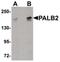 Partner And Localizer Of BRCA2 antibody, PA5-20796, Invitrogen Antibodies, Western Blot image 