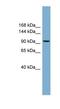 Protein Phosphatase 1 Regulatory Subunit 3A antibody, NBP1-59934, Novus Biologicals, Western Blot image 