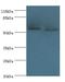 DDB1 And CUL4 Associated Factor 4 antibody, LS-C371912, Lifespan Biosciences, Western Blot image 