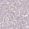 CD47 Molecule antibody, HPA044659, Atlas Antibodies, Immunohistochemistry paraffin image 