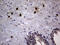Myeloblastin antibody, LS-C791202, Lifespan Biosciences, Immunohistochemistry paraffin image 