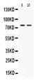 Activin A Receptor Type 2A antibody, PB10027, Boster Biological Technology, Western Blot image 