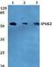 Inositol Hexakisphosphate Kinase 2 antibody, A08792-1, Boster Biological Technology, Western Blot image 