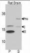 Microtubule Associated Protein 1 Light Chain 3 Beta antibody, PA5-35195, Invitrogen Antibodies, Western Blot image 