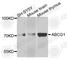 ATP Binding Cassette Subfamily G Member 1 antibody, A4328, ABclonal Technology, Western Blot image 
