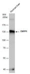 Ectonucleotide Pyrophosphatase/Phosphodiesterase 1 antibody, GTX103447, GeneTex, Western Blot image 