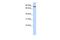 Transferrin Receptor 2 antibody, PA5-42733, Invitrogen Antibodies, Western Blot image 