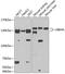 Ubiquitination Factor E4A antibody, GTX64985, GeneTex, Western Blot image 