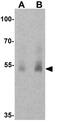 Solute Carrier Family 29 Member 1 (Augustine Blood Group) antibody, GTX31946, GeneTex, Western Blot image 