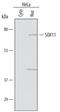 Transcription factor SOX-11 antibody, PA5-47557, Invitrogen Antibodies, Western Blot image 