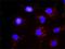 Platelet Derived Growth Factor Receptor Beta antibody, H00005159-M08, Novus Biologicals, Proximity Ligation Assay image 