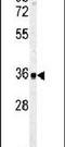 Carbonic Anhydrase 4 antibody, PA5-14386, Invitrogen Antibodies, Western Blot image 