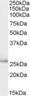 TPD52 Like 1 antibody, EB08026, Everest Biotech, Western Blot image 