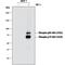 Ribosomal Protein S6 Kinase B1 antibody, MAB8964, R&D Systems, Western Blot image 