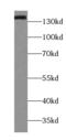 Tripeptidyl Peptidase 2 antibody, FNab08896, FineTest, Western Blot image 