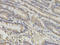 G Protein Subunit Alpha O1 antibody, A05532, Boster Biological Technology, Immunohistochemistry paraffin image 