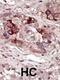 Phosphorylase Kinase Catalytic Subunit Gamma 2 antibody, 62-746, ProSci, Immunohistochemistry paraffin image 