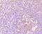 DEAD-Box Helicase 6 antibody, A03826, Boster Biological Technology, Immunohistochemistry paraffin image 