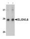 ELOVL Fatty Acid Elongase 6 antibody, ab69857, Abcam, Western Blot image 