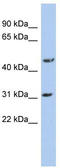 Dihydrolipoamide Branched Chain Transacylase E2 antibody, TA340035, Origene, Western Blot image 