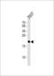 HRas Proto-Oncogene, GTPase antibody, MBS9202644, MyBioSource, Western Blot image 