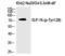 Lymphocyte Cytosolic Protein 2 antibody, PA5-40272, Invitrogen Antibodies, Western Blot image 